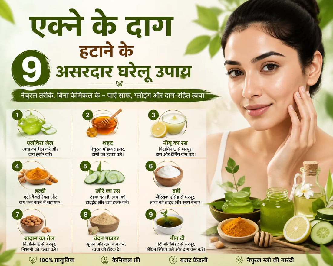 एक्ने के दाग हटाने के 9 असरदार घरेलू उपाय