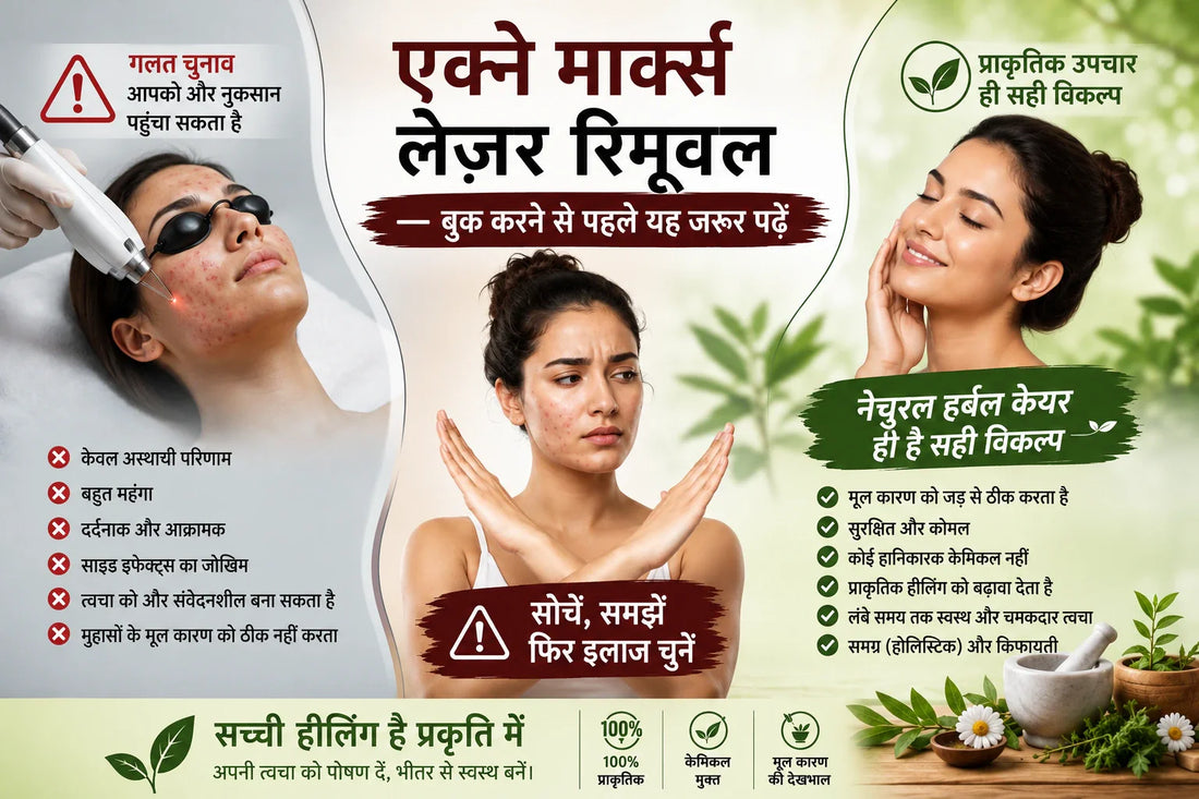 एक्ने के दाग Laser से हटाएं — पहले यह पढ़ें | Divine Era Herbal