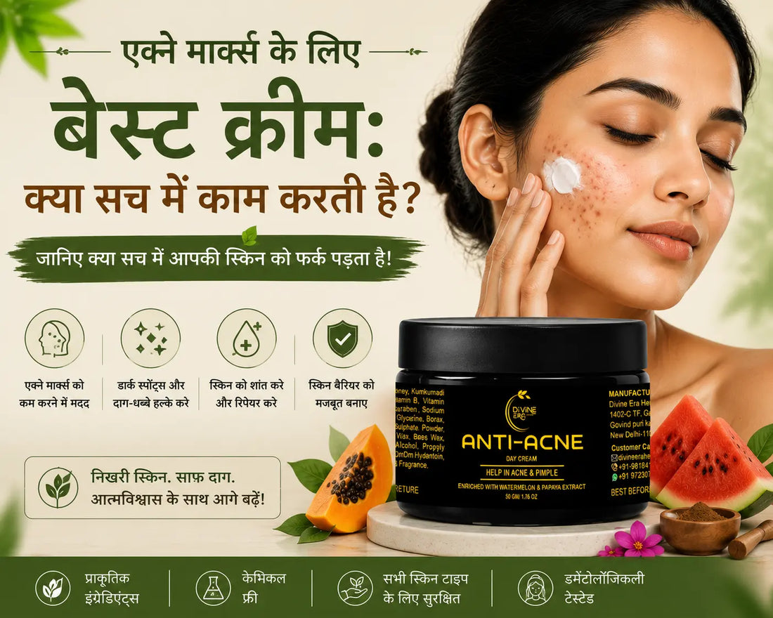 एक्ने के दाग-धब्बों के लिए सबसे अच्छी क्रीम कौन सी है?
