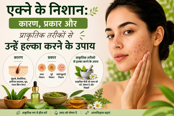 एक्ने के दाग: कारण, प्रकार और प्राकृतिक उपचार | Divine Era Herbal