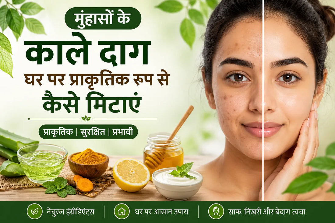 मुंहासों के काले दाग घर पर प्राकृतिक रूप से कैसे मिटाएं