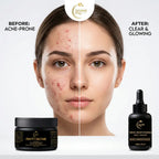Divine Era Herbal Acne Cream & Face Brightening Serum Combo Kit