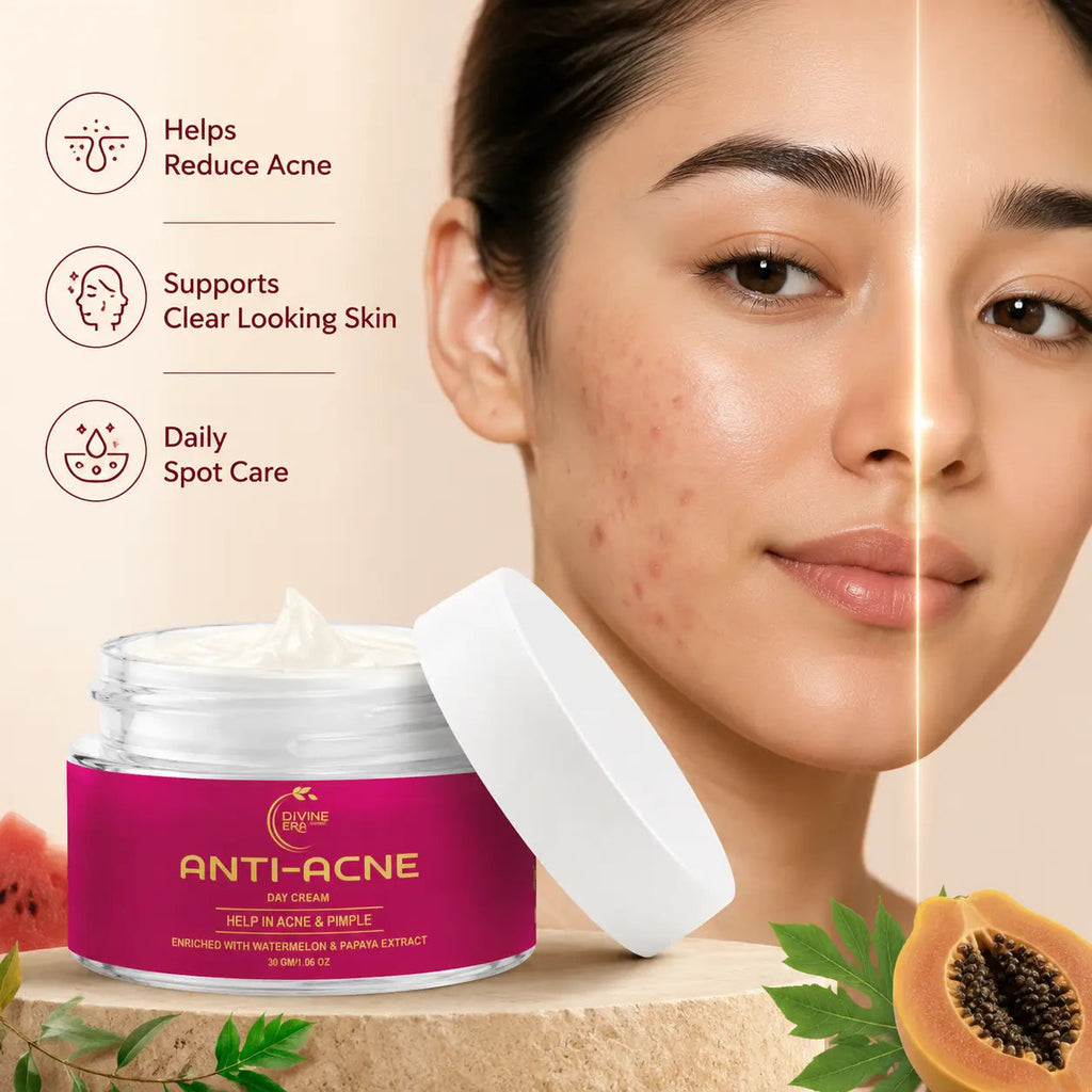 Anti Acne Cream 30gm | Pimple Control & Acne Spot Reduction Cream Divine Era Herbal
