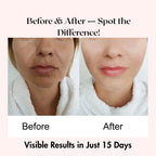 Divine Era Herbal Anti Blemish Cream 50gm | Dark Spots & Blemish Removal Cream Divine Era Herbal