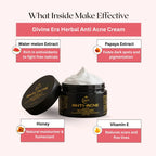 Anti Acne Cream 50gm | Pimple Control & Acne Spot Reduction Cream Divine Era Herbal