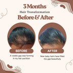 Hair Fall Control Serum