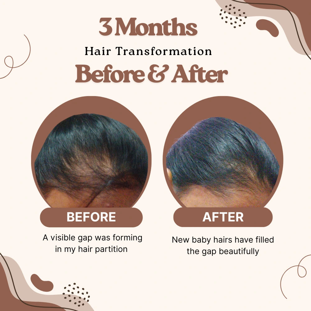 Hair Fall Control Serum