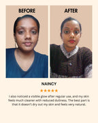 De Pigmentation Kit – Kumkumadi Cream & Face Serum for Dark Spots, Pigmentation & Uneven Skin Tone