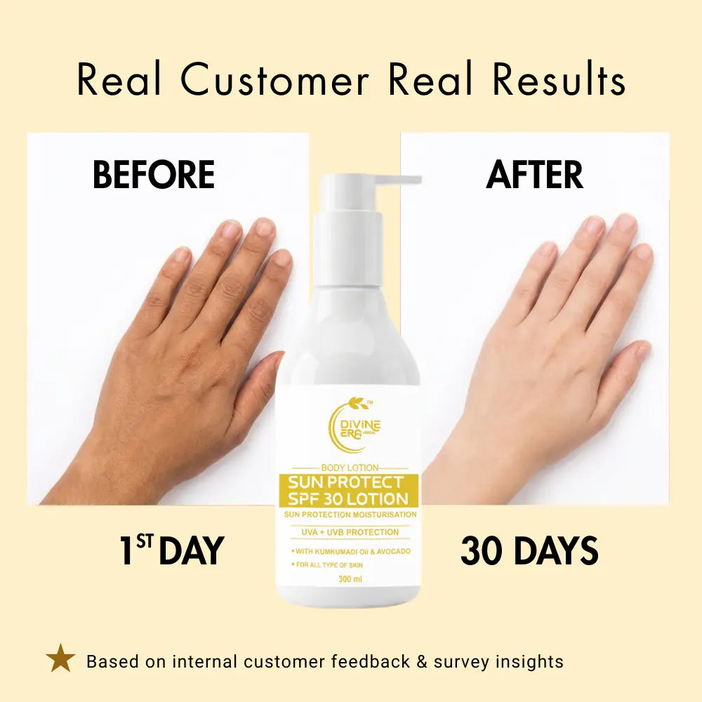 Sun Protect SPF 30 Body Lotion 300ml | Daily Moisturizing & UV Protection Lotion
