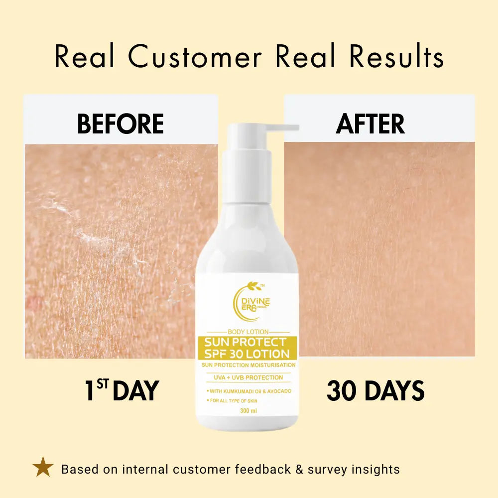 Sun Protect SPF 30 Body Lotion 300ml | Daily Moisturizing & UV Protection Lotion