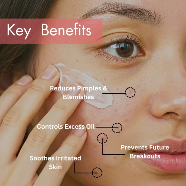 This detailed infographic highlights the active ingredients that make the Divine Era Herbal Anti Acne Cream effective. The main image features an open jar of the cream showing its rich, white texture. Around the jar, four key components and their specific benefits are outlined: Watermelon Extract: Rich in antioxidants to fight free radicals. Papaya Extract: Fades dark spots and pigmentation. Honey: Acts as a natural moisturizer and humectant. Vitamin E: Reduces scars and fine lines. The overall presentation emphasizes that the cream's efficacy stems from a blend of natural, skin-nourishing ingredients, targeting not only active acne but also concerns like pigmentation, scarring, and dryness.