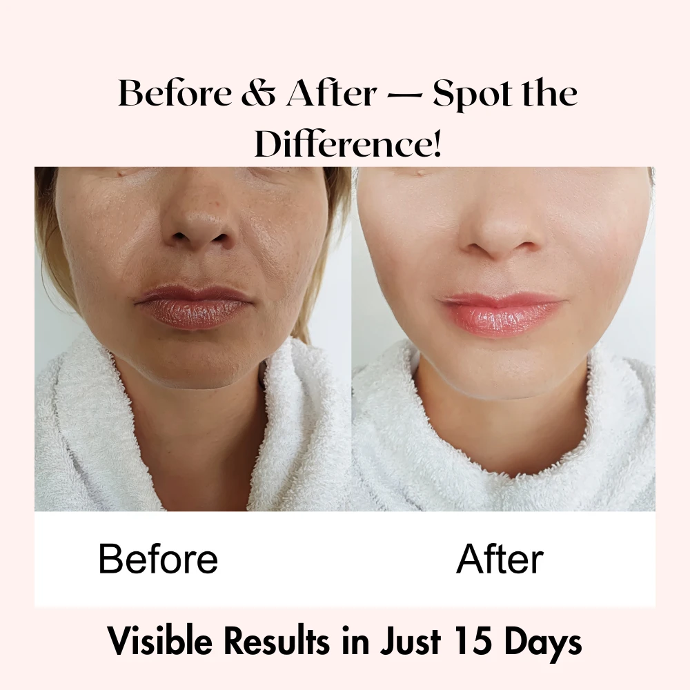 Don't just take our word for it—see the difference! Visible results in just 15 days with the best cream for dark spots on face. Get started on your journey to clear skin today!