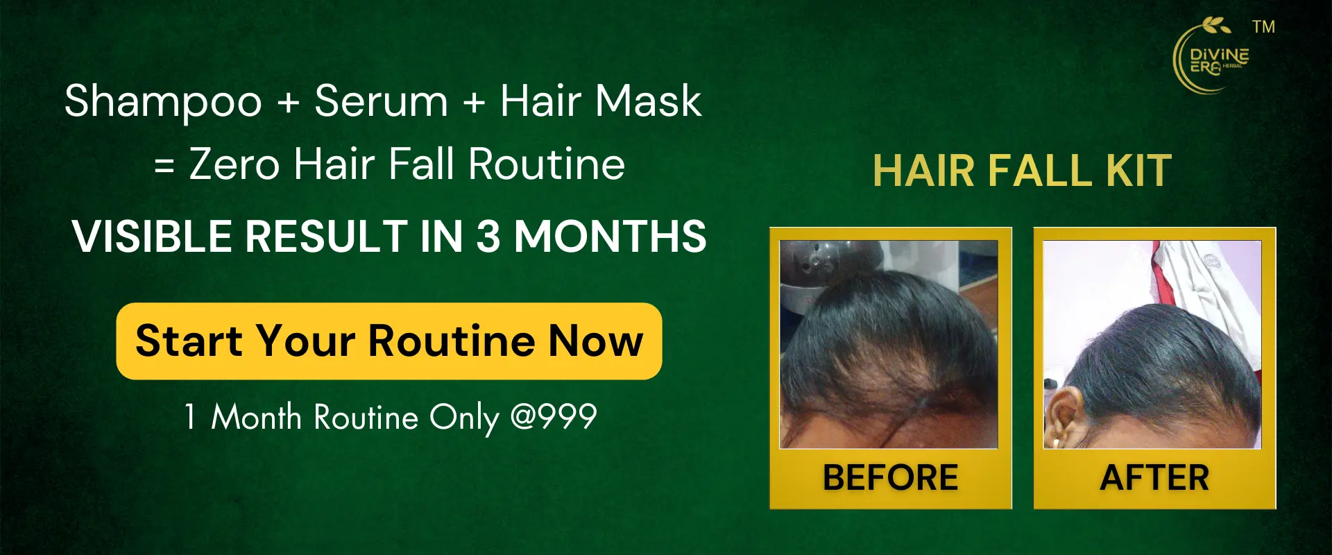 Herbal Hair Fall Control Kit made with natural ingredients – best natural beauty products online India